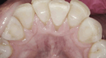 Content Dam Diq Online Articles 2016 09 1609orkos Thumb