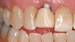 Content Dam Diq Online Articles 2016 09 16sept15piafroum T Content Dam Diq Online Articles 2016 09 16sept15piafroum T