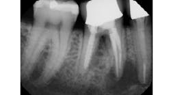 Content Dam Diq Online Articles 2017 01 17jan12piafroum Thumbnail Content Dam Diq Online Articles 2017 01 17jan12piafroum Thumbnail