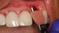 Content Dam Diq Online Articles 2017 01 17jan12piamann Thumbnail Content Dam Diq Online Articles 2017 01 17jan12piamann Thumbnail