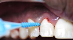 Content Dam Diq Online Articles 2017 02 17feb9piainsanity Thumb Content Dam Diq Online Articles 2017 02 17feb9piainsanity Thumb