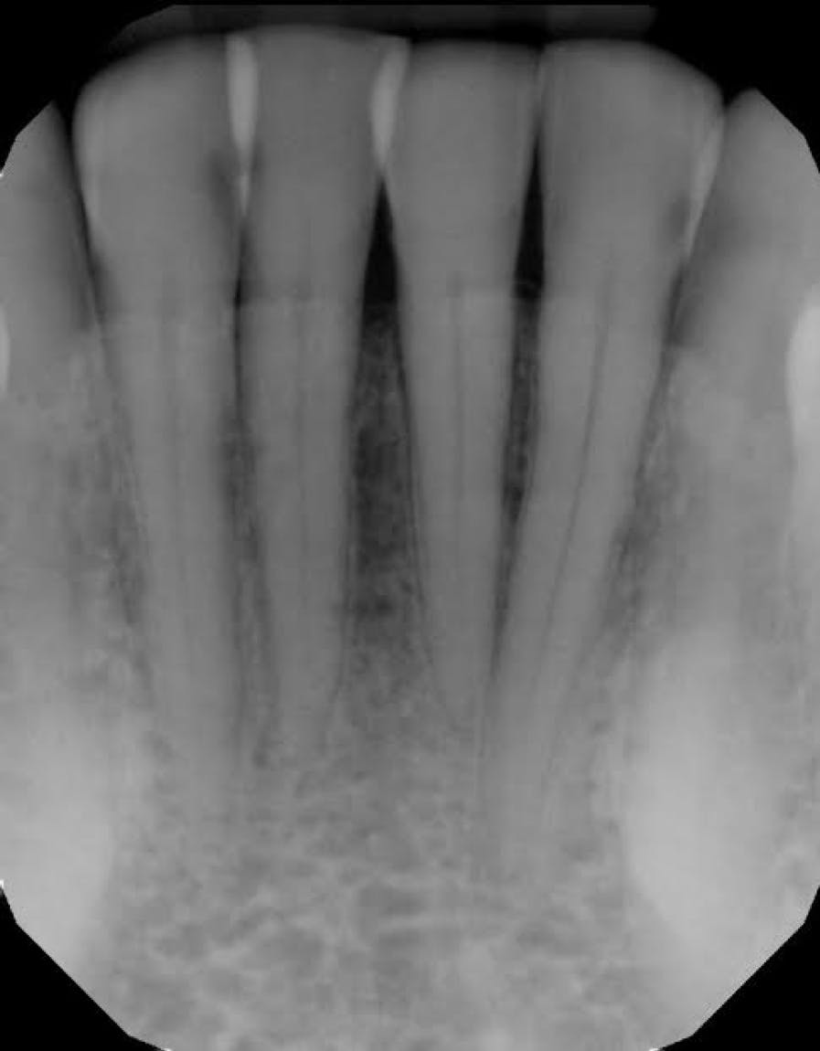 Figure 1 Vaping Oral Health Dentistry
