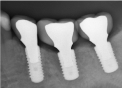 Walton Figure 1 Walton Figure 1