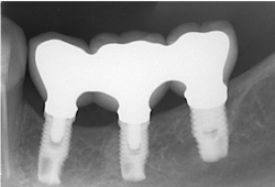 Walton Figure 2 Walton Figure 2