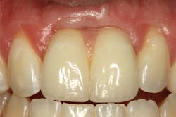 Walton Figure 3 Walton Figure 3