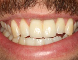 Walton Figure 3a Walton Figure 3a