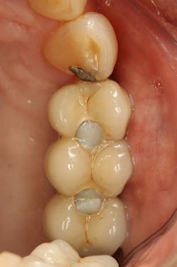 Walton Figure 4 Walton Figure 4