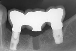 Walton Figure 4a Walton Figure 4a