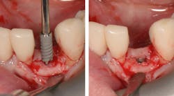 Content Dam Sr Online Articles 2019 02 19feb14piapalmant Content Dam Sr Online Articles 2019 02 19feb14piapalmant