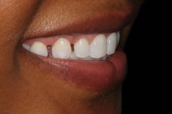 19mar14piawei01 19mar14piawei01