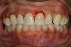 19mar14piawei03 19mar14piawei03