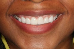 19mar14piawei04 19mar14piawei04