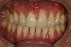 19mar14piawei05 19mar14piawei05