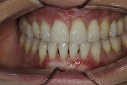 19mar14piawei06 19mar14piawei06