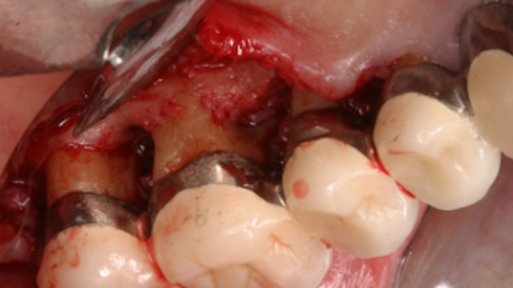 Content Dam Sr Online Articles 2019 04 19apr11piaramost