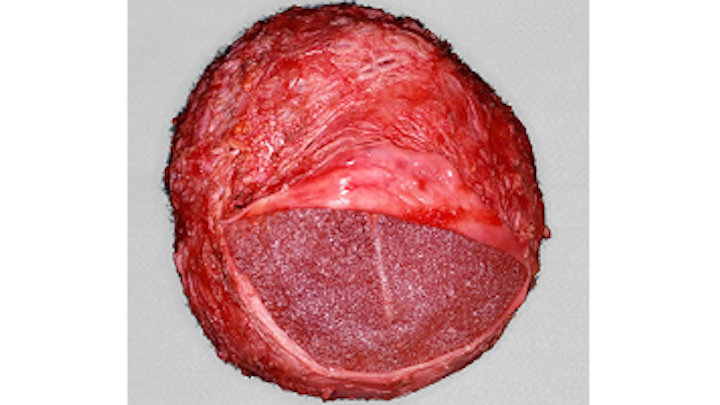 Content Dam Sr Online Articles 2019 05 19may9piaclintipt