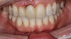 19 Jun13 Pi Aclintip04 19 Jun13 Pi Aclintip04