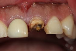 Figure 8: Type 1b socket Figure 8: Type 1b socket