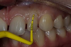 Figure 9: Type 1c socket Figure 9: Type 1c socket