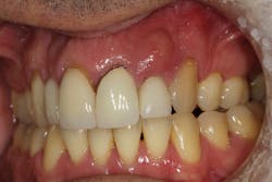 Figure 10a: Type 2 socket Figure 10a: Type 2 socket