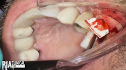 19 Aug8 Pi Aclintip 19 Aug8 Pi Aclintip