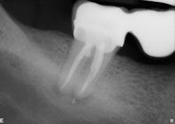Figure 2: Six-month recall—case 1 Figure 2: Six-month recall—case 1