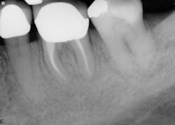 Figure 4: Six-month recall—case 2 Figure 4: Six-month recall—case 2