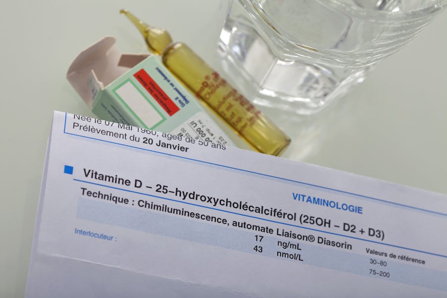 Figure 2: Testing vitamin D levels