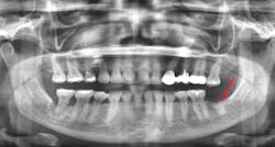 Figure 3a: Figure 3a: