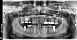 Figure 3b: Figure 3b: