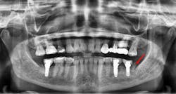 Figure 3c: Figure 3c: