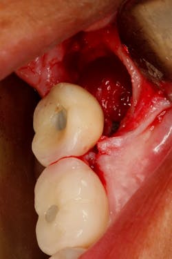 Figure 3e: Figure 3e: