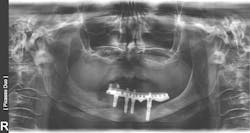 Figure 5a: Figure 5a: