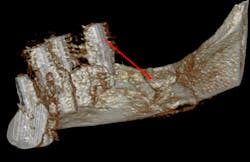 Figure 5c: Figure 5c: