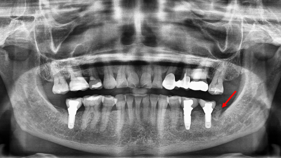 20 Feb13 Pi Ale Primary