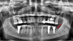 20 Feb13 Pi Ale Primary 5e3ae37512c91 20 Feb13 Pi Ale Primary 5e3ae37512c91