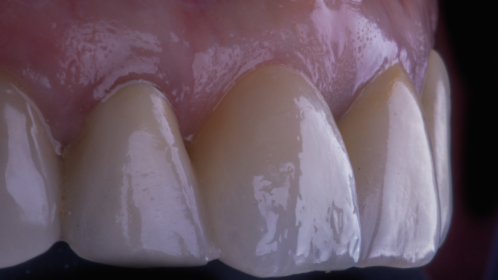 20 Mar12 Pi Agluckman P05