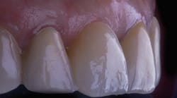 20 Mar12 Pi Agluckman P05 20 Mar12 Pi Agluckman P05