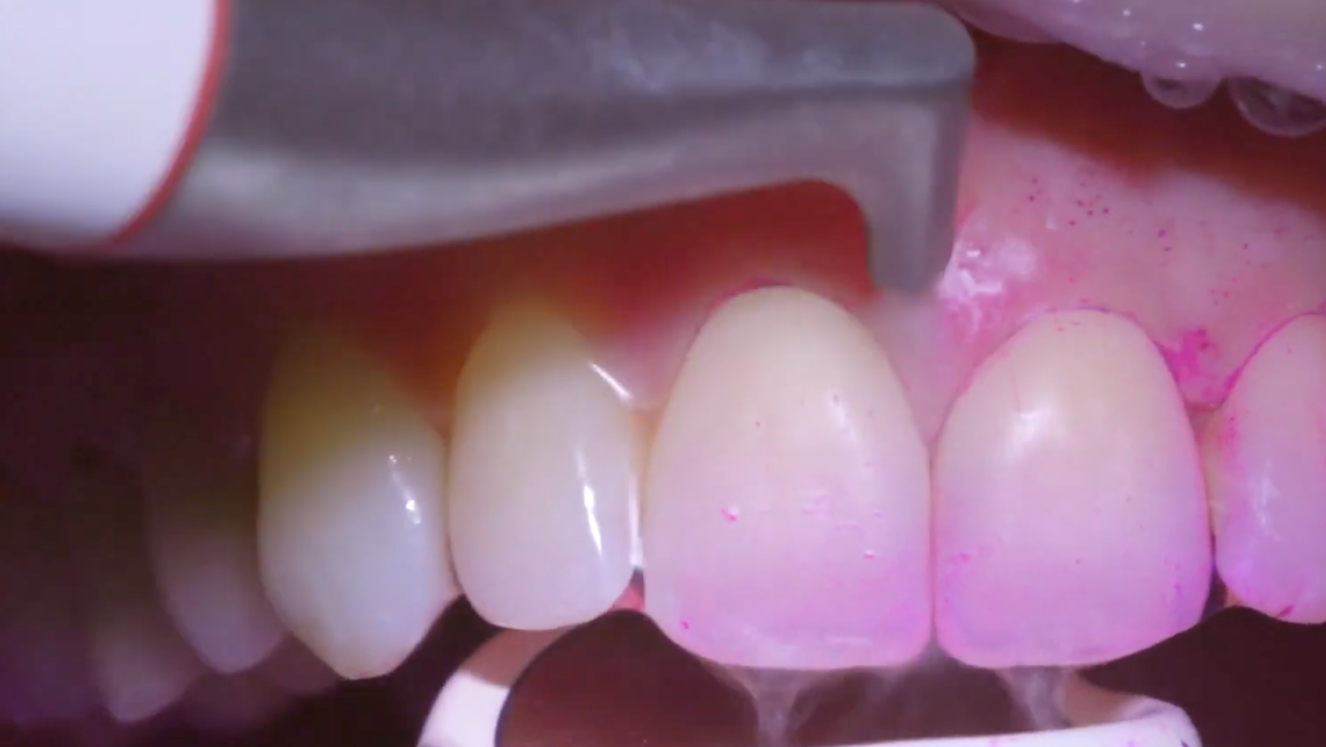 20 Mar12 Pi Astrange01