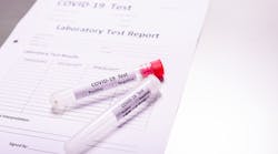 Copyright Joaquin Corbalan Dreamstime Serology Testing Covid19 Copyright Joaquin Corbalan Dreamstime Serology Testing Covid19