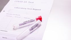 Copyright Joaquin Corbalan Dreamstime Serology Testing Covid19 5e99de4a80323 Copyright Joaquin Corbalan Dreamstime Serology Testing Covid19 5e99de4a80323