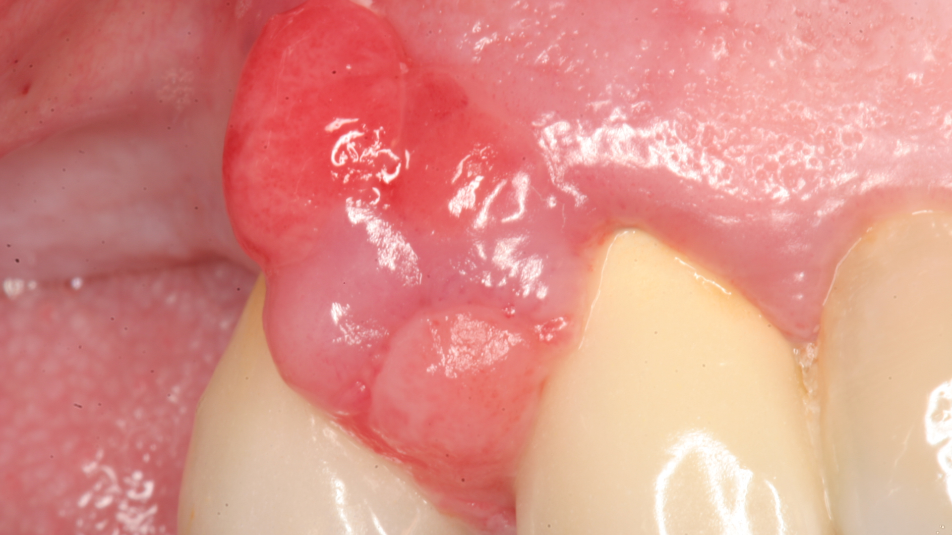 20 Jun11 Pi Aperiotherapy01 5ede90bf4a868