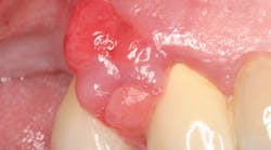 20 Jun11 Pi Aperiotherapy01 20 Jun11 Pi Aperiotherapy01