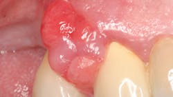 20 Jun11 Pi Aperiotherapy01 5ede90bf4a868 20 Jun11 Pi Aperiotherapy01 5ede90bf4a868