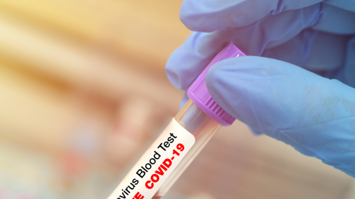 Covid 19 Testing In The Dental Office How When And Why Perio Implant Advisory