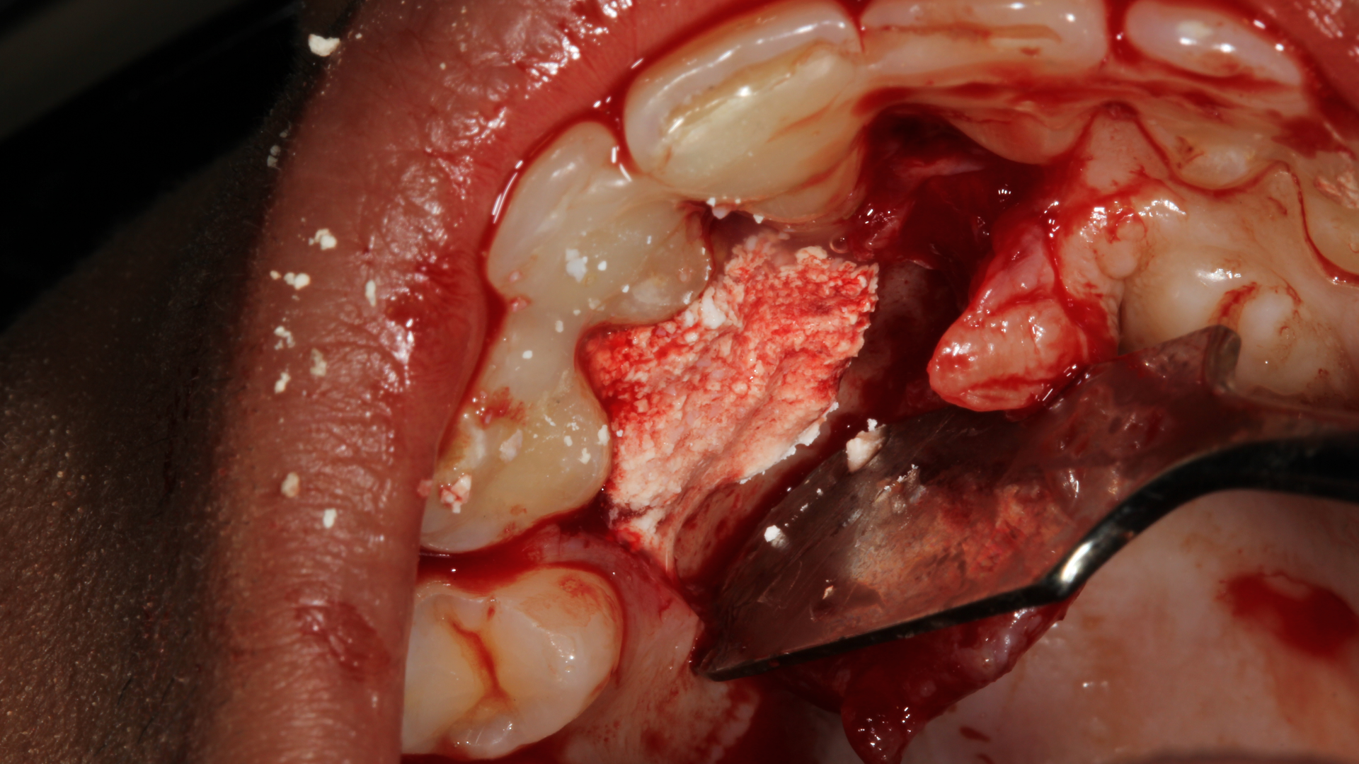 20 Aug13 Pi Afroumsum04 5f2d8d8a6acb0