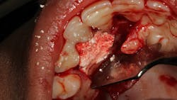 20 Aug13 Pi Afroumsum04 5f2d8d8a6acb0 20 Aug13 Pi Afroumsum04 5f2d8d8a6acb0