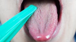 Dreamstime Xl 169530427 Dreamstime Xl 169530427