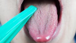 Dreamstime Xl 169530427 5fbe947b45b50 Dreamstime Xl 169530427 5fbe947b45b50