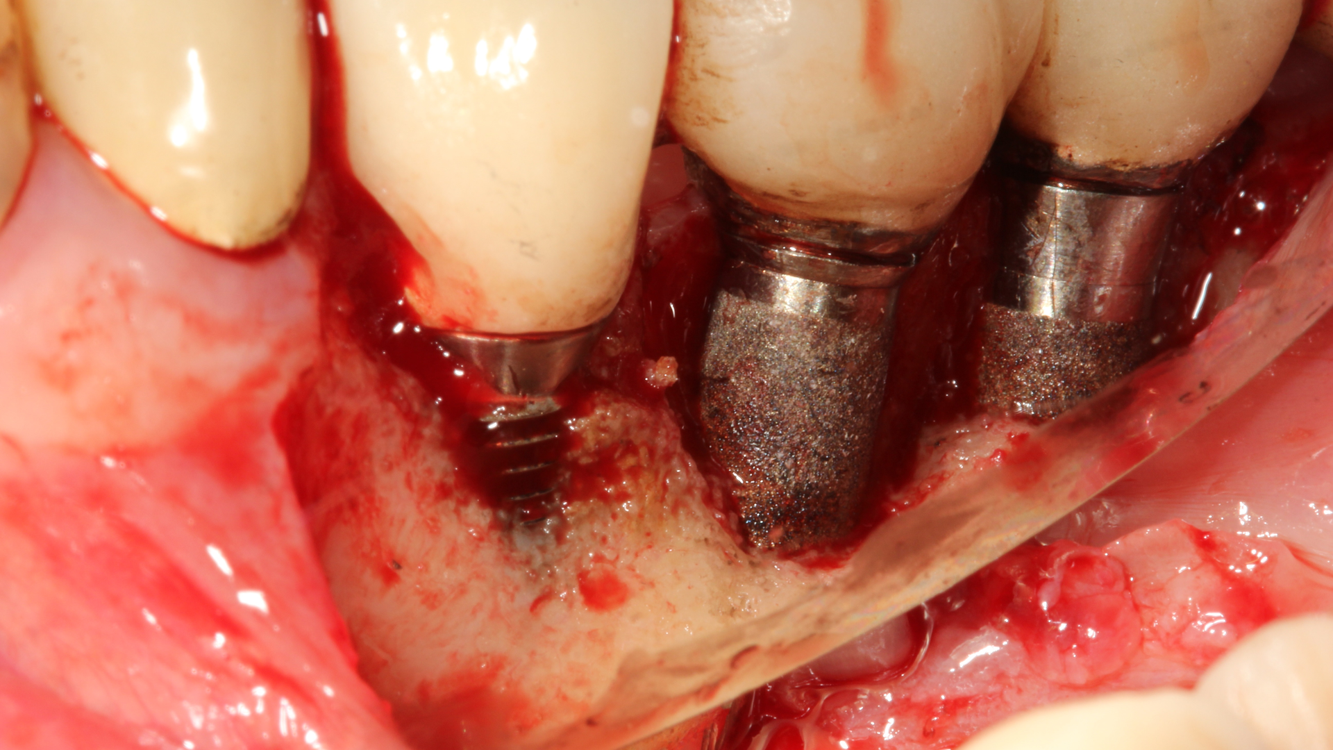 21 Jan14 Pi Afroum Primary 5ff3714a8f93d